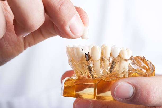 istockphoto-177818774-612x612