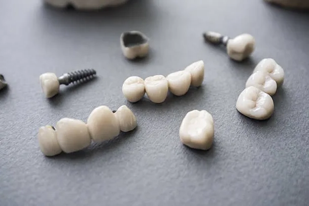 Tandproteser och implantat delar